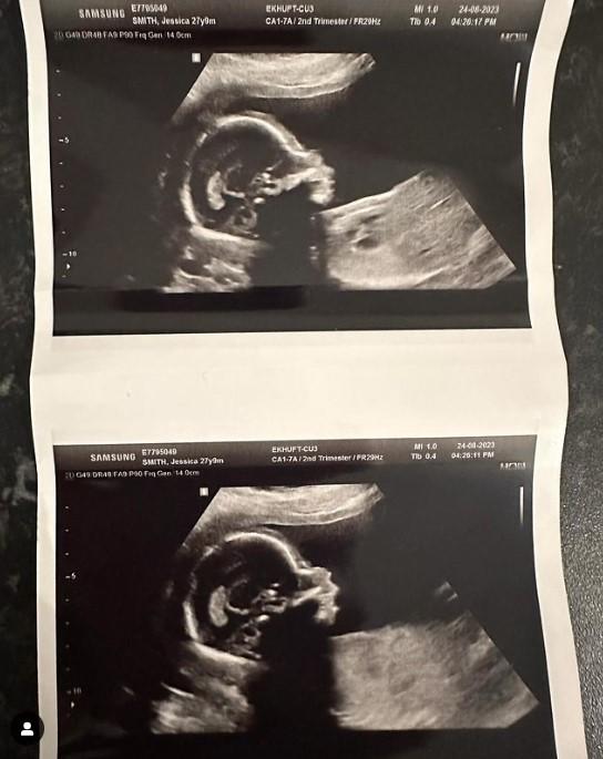 Jess Smith透過社交網親自報喜,並公開胎兒的超聲波照片。