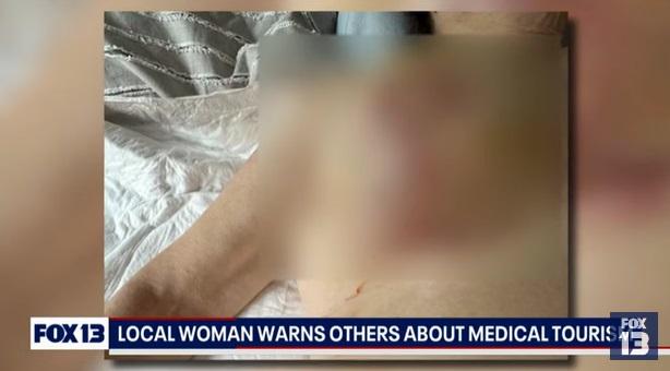 麥考密克無端「被隆胸」。(互聯網)