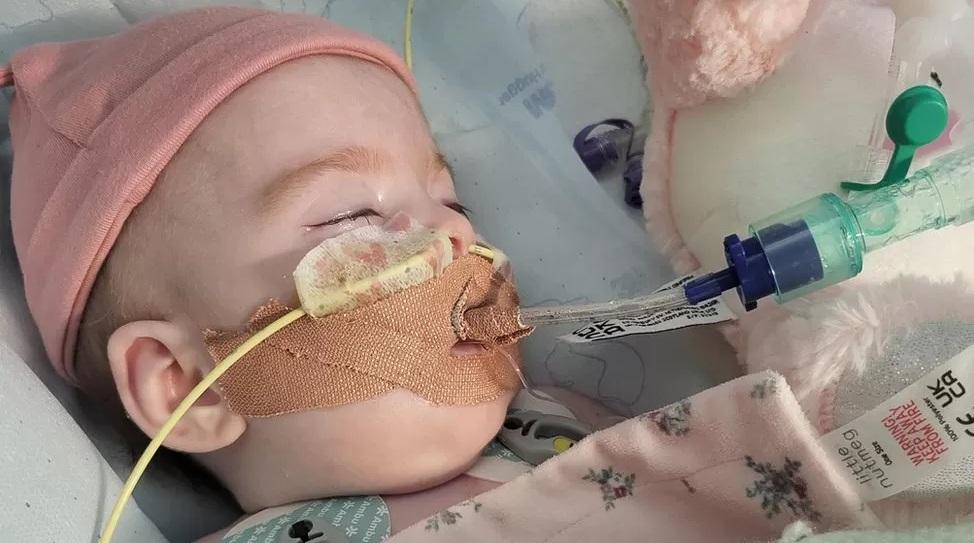 女嬰格雷戈里患上罕見粒線體疾病。(互聯網)