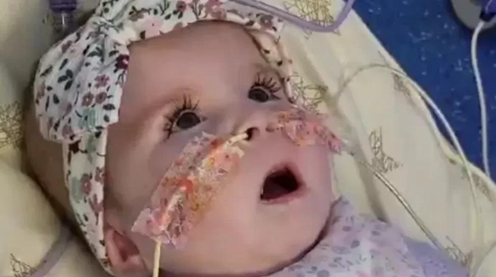 女嬰格雷戈里患上罕見粒線體疾病。(互聯網)