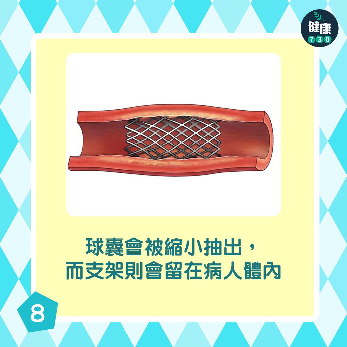 通波仔手術過程