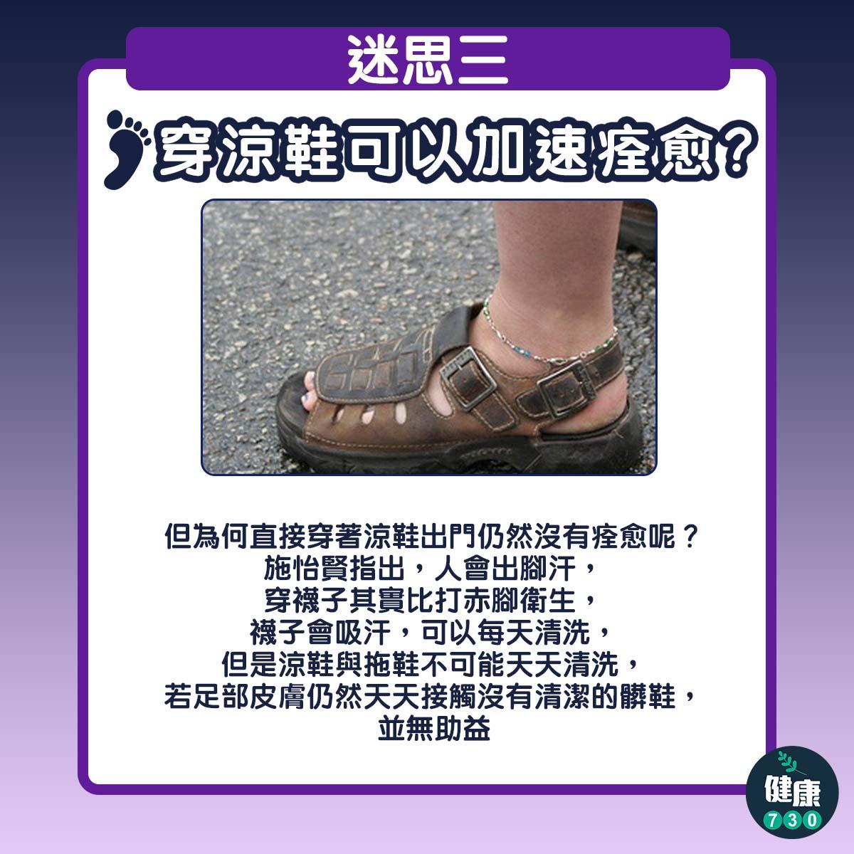 香港腳治療|搽藥膏、著涼鞋無效?破解足癬3大迷思