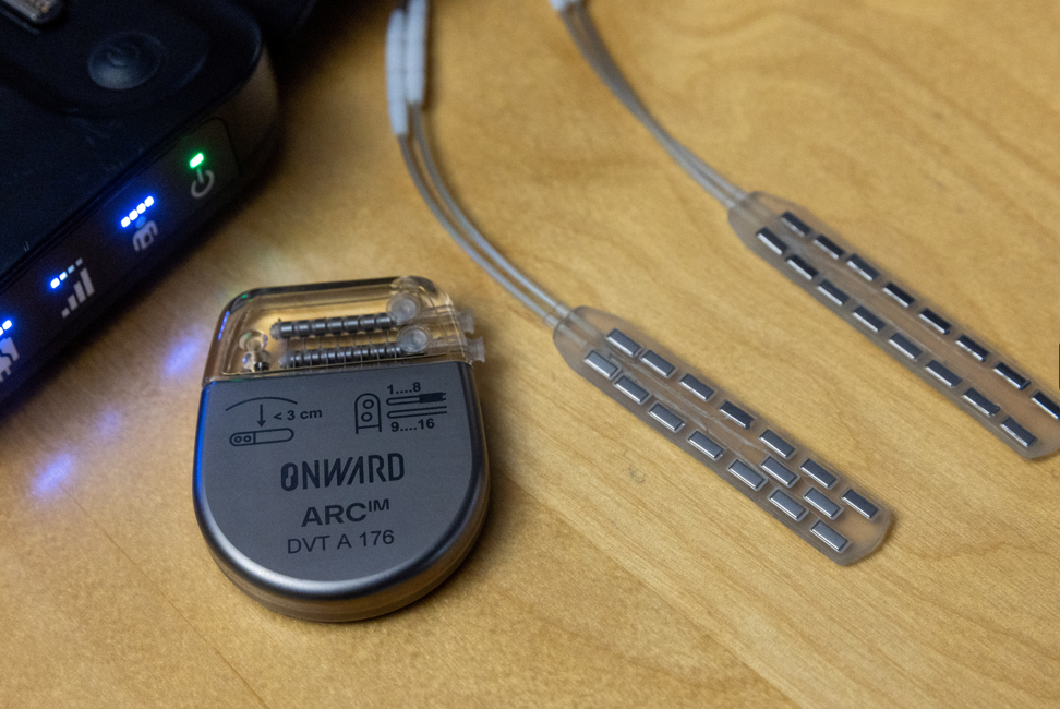 法國一名患了柏金遜症30年的晚期患者,在脊椎植入一個瑞士團隊設計的全新電極裝置後,恢復幾乎正常的步行能力(路透社)