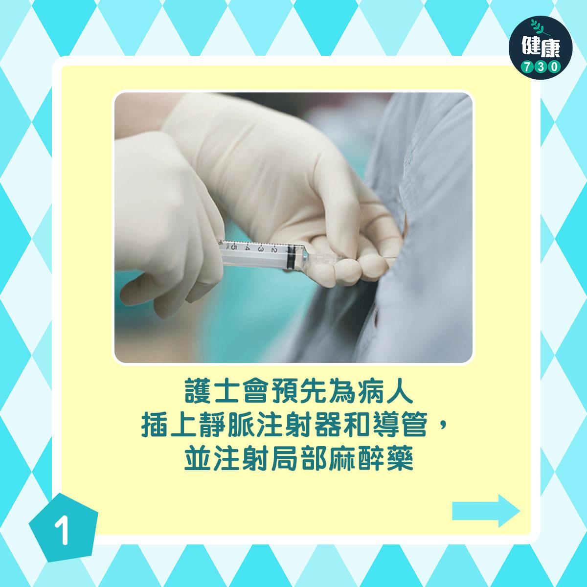 通波仔手術過程