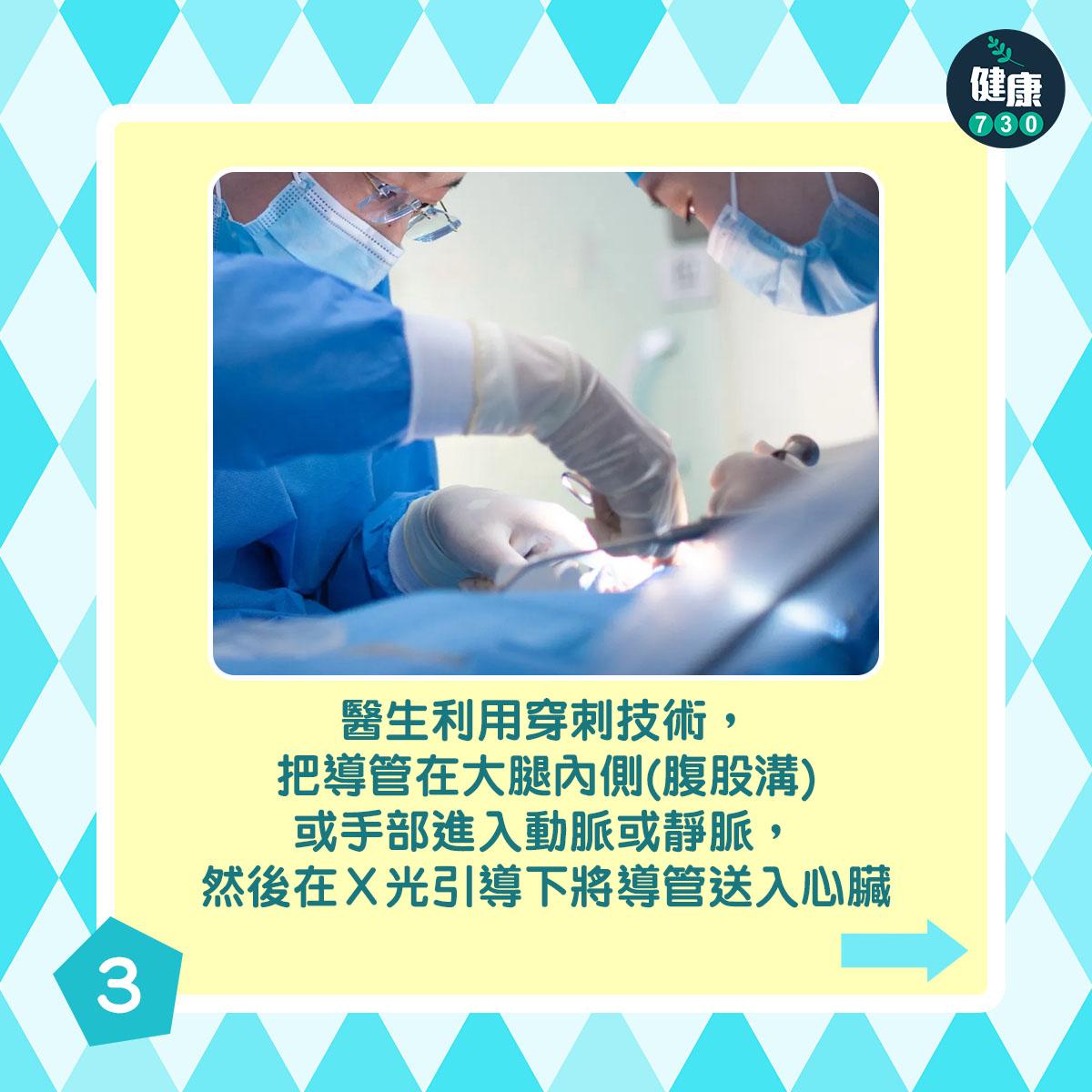 通波仔手術過程