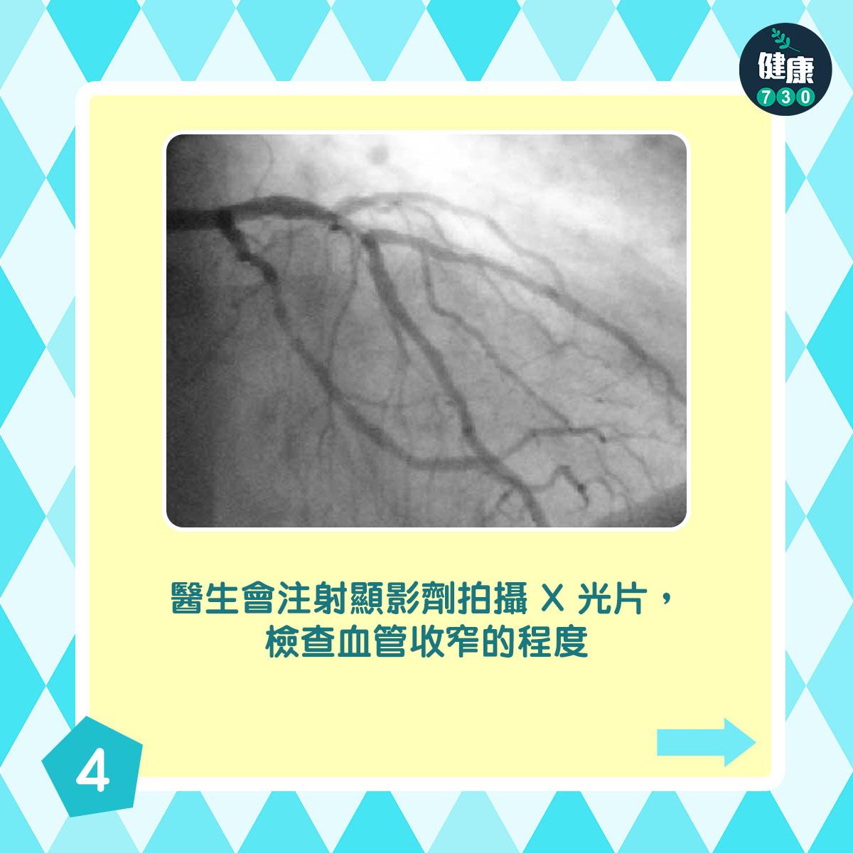 通波仔手術過程