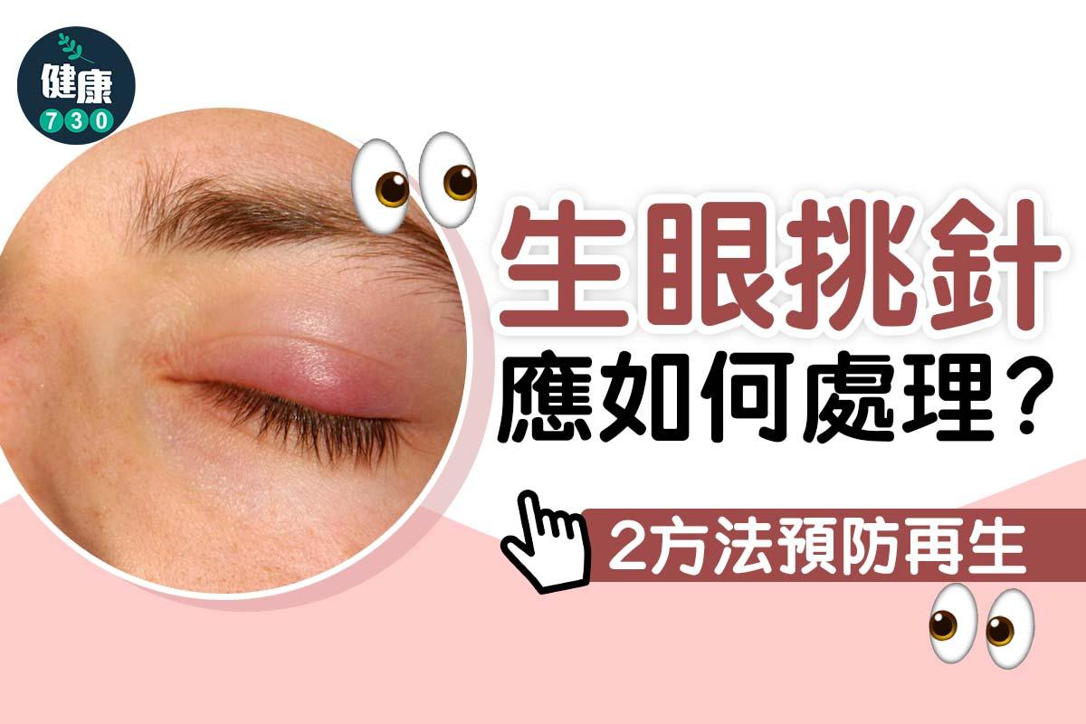 眼挑針解決方法及預防重點(am730製圖)