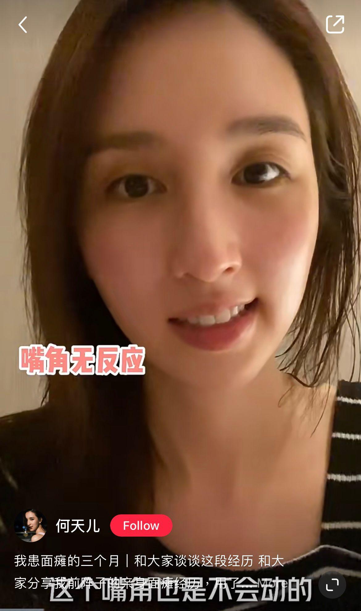 何天兒原名何傲兒,早前於小紅書分享康復心得(何天兒小紅書)