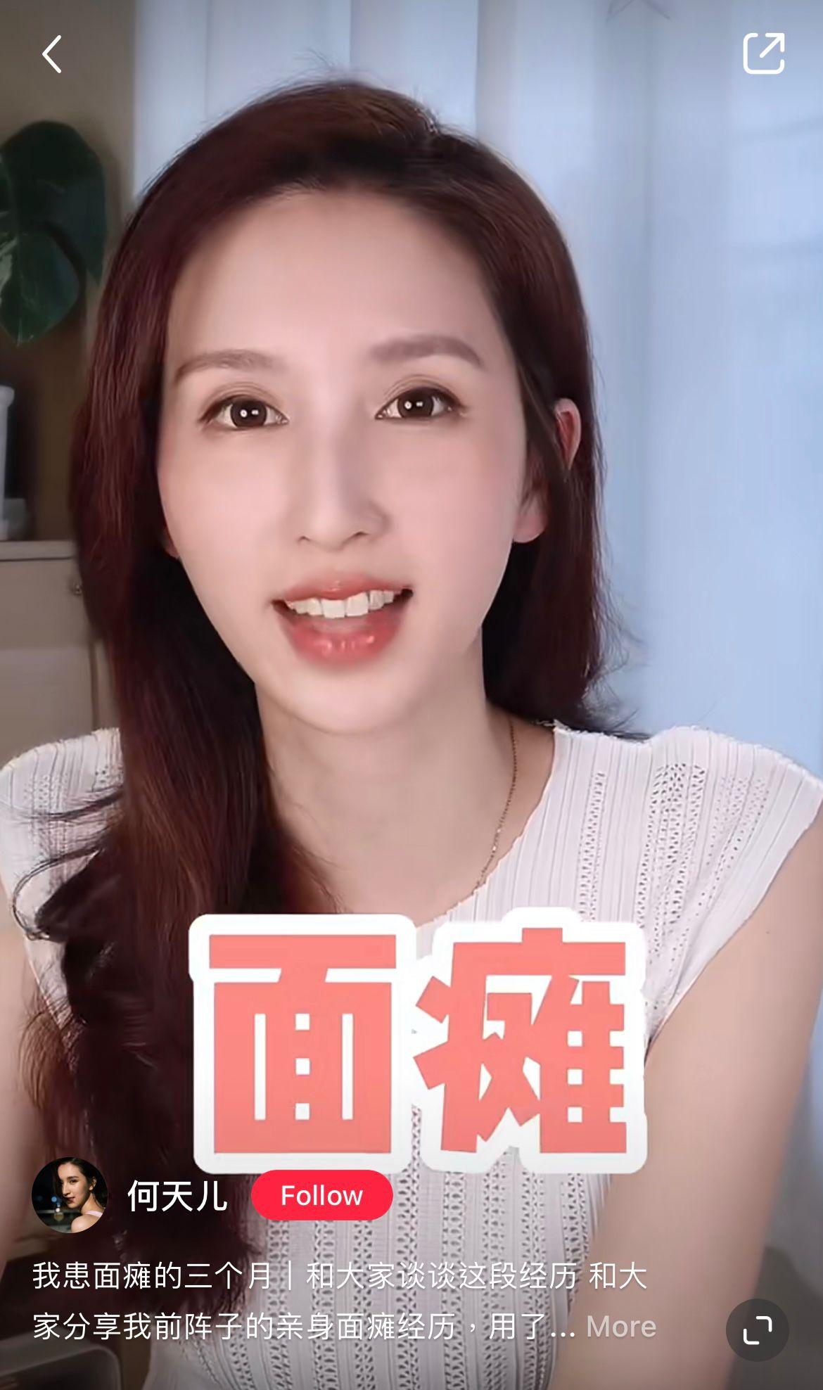 何天兒原名何傲兒,早前於小紅書分享康復心得(何天兒小紅書)