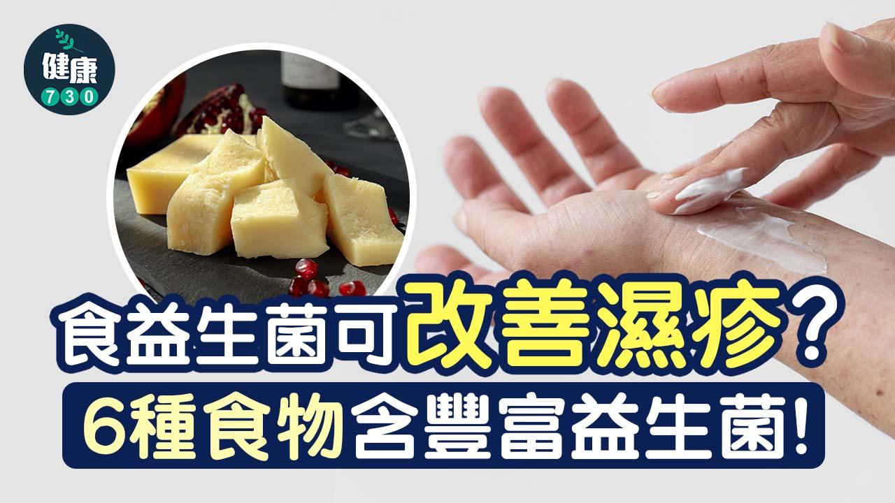 濕疹|食益生菌可改善皮膚狀況?6種食物含豐富益生菌!