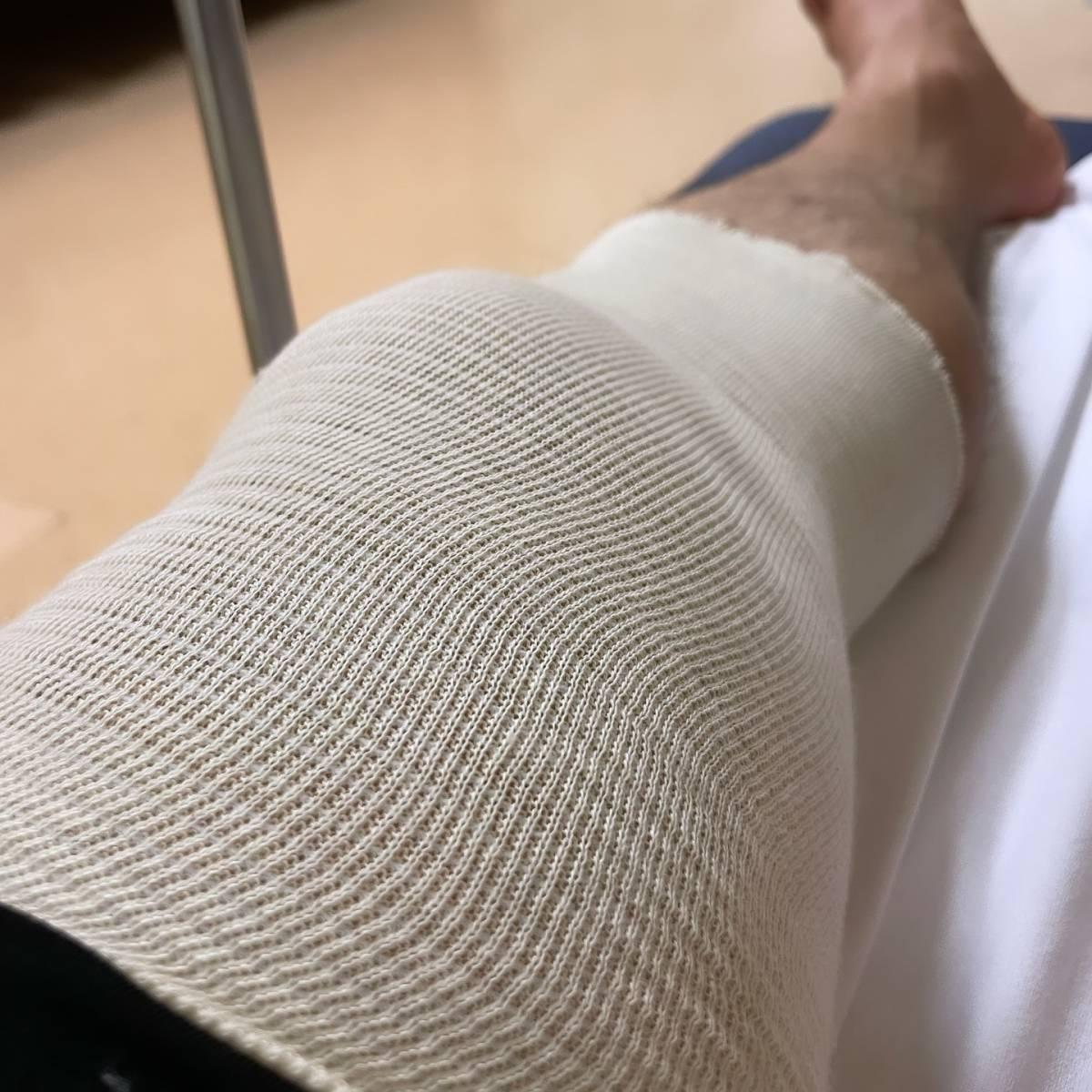 陳健安On仔踢足球左膝嚴重受傷,前十字韌帶完全斷裂(陳健安IG)