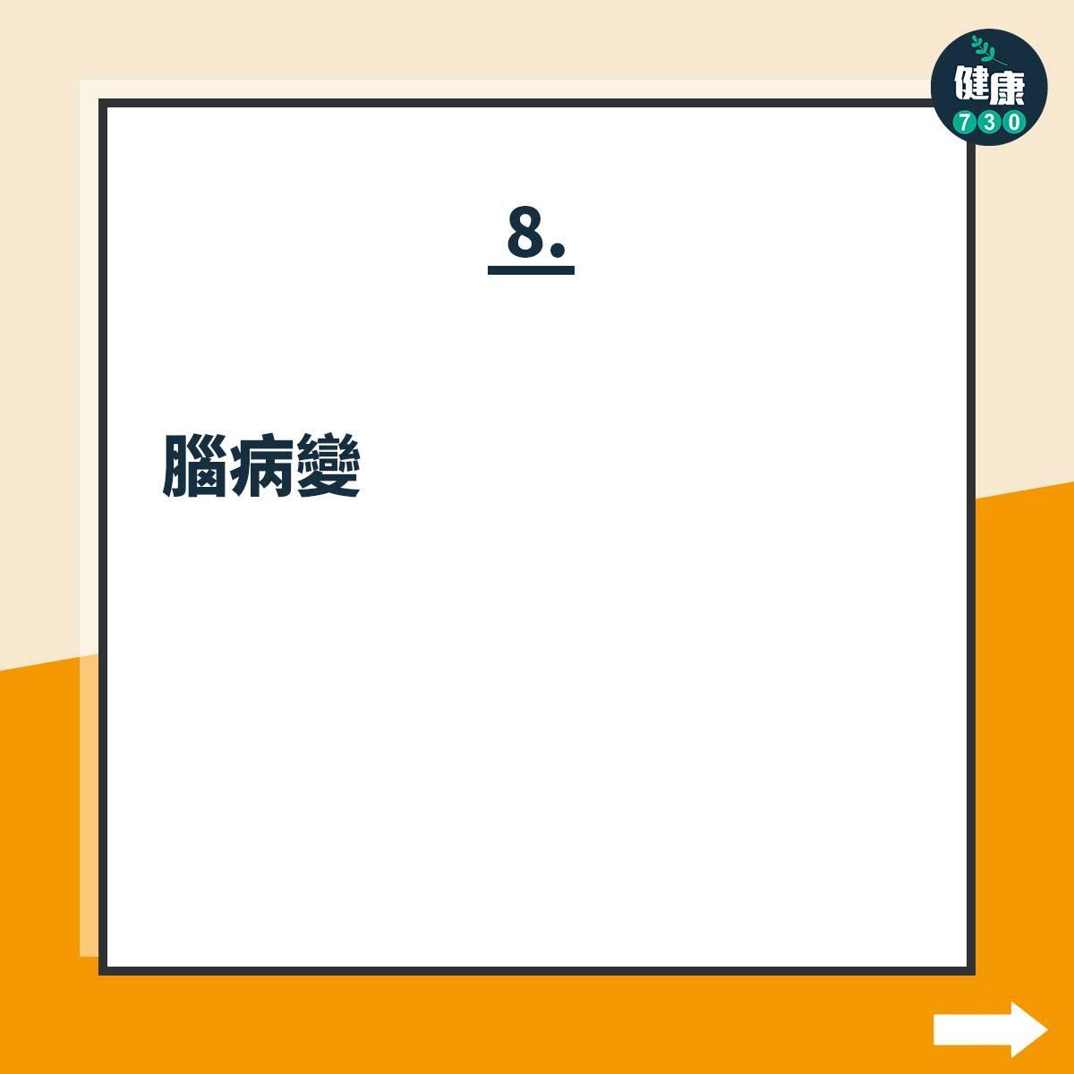 Celine Dion患上僵硬人症候群,病徵如下(am730製圖)