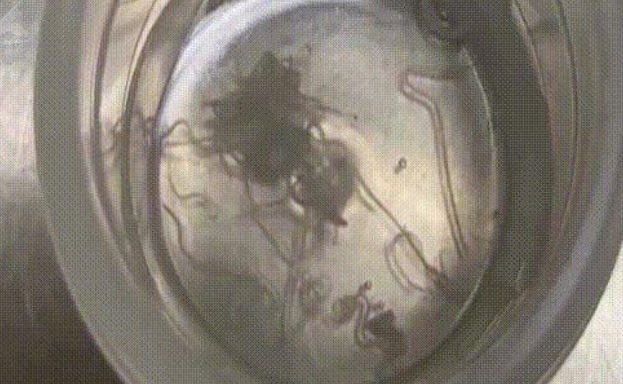 雲南昆明一名女子近日眼睛不舒服,揉眼時竟掉出一條蟲在手上爬,她大驚趕赴醫院就診。醫生檢查時翻開眼皮,能看到一條條絲線樣的白色寄生蟲不停地蠕動,最終從右眼取出40多隻蟲子,左眼取出10多條。