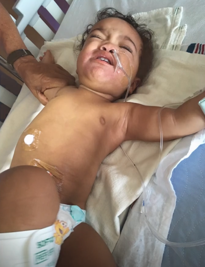 女嬰Kipley Haugen於2017年誤吃水珠後入院。(互聯網)