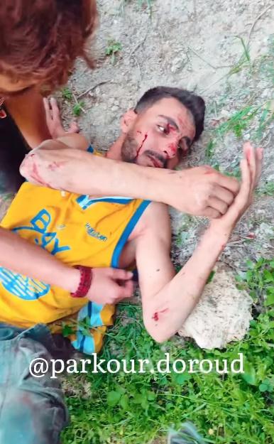 Hussein躺在地上,面有血跡,神情痛楚。(X)