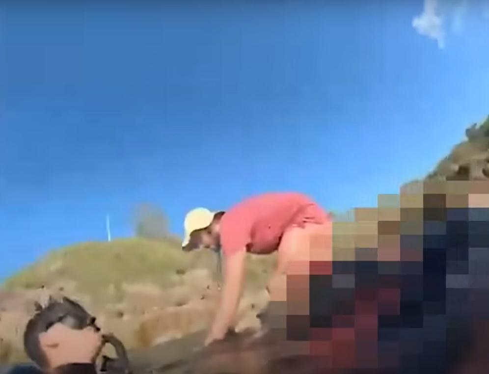 畫面中隱約可看見Matteo的小腿和足踝有明顯被割開的傷口。(IG)