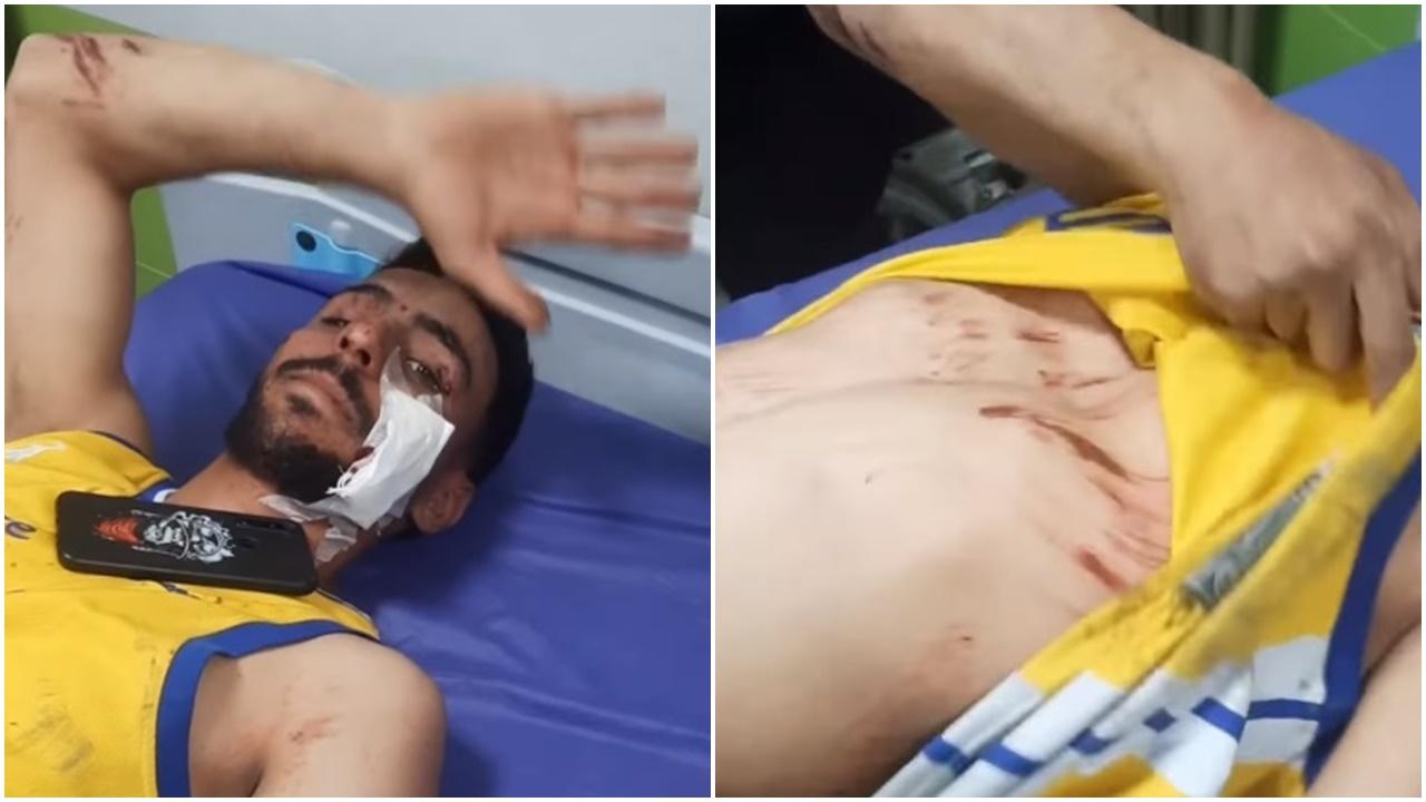 Hussein在醫院拍片報平安。(X)