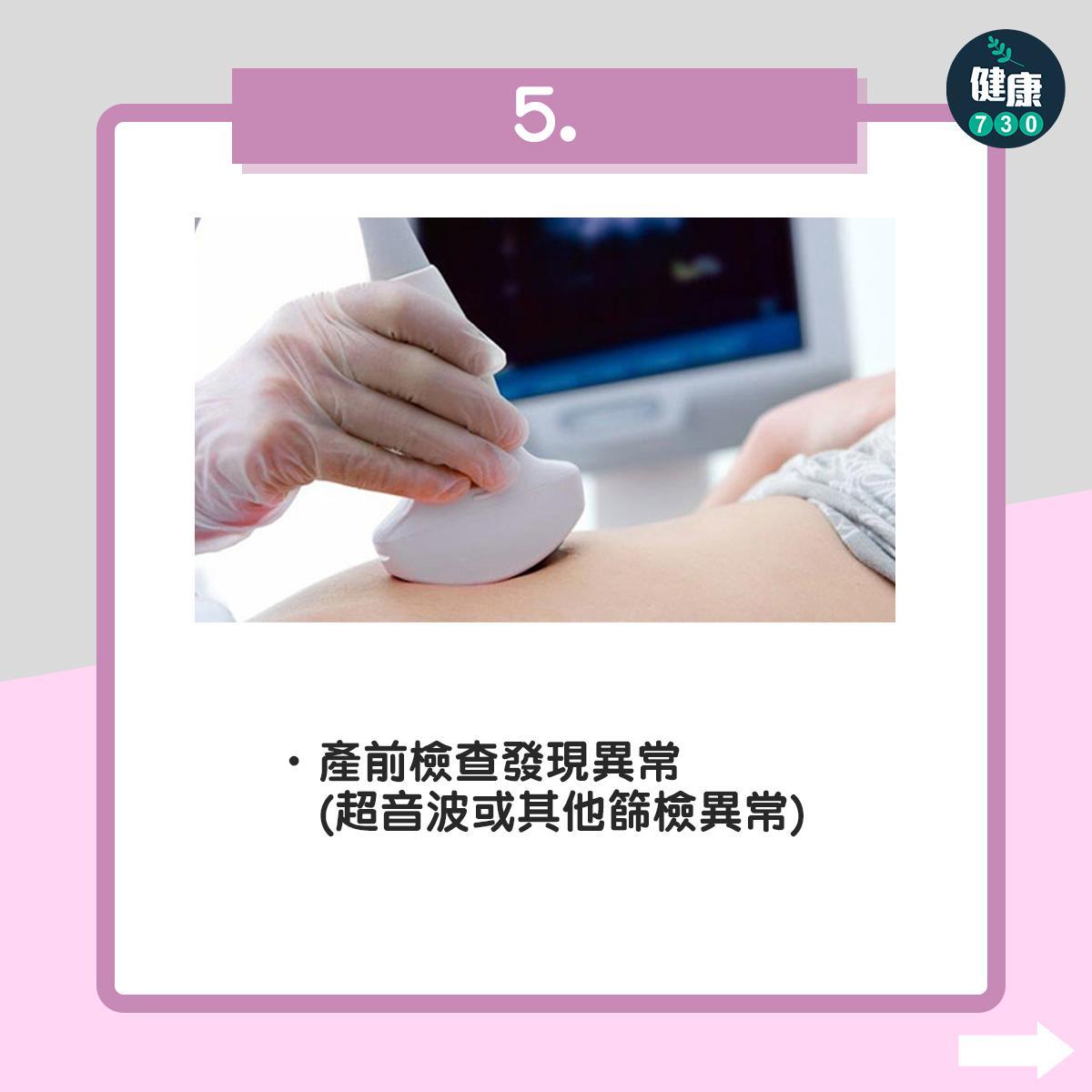 結婚生育|高齡孕婦等7種人,建議接受產前遺傳診斷與遺傳諮詢 (am730製圖)