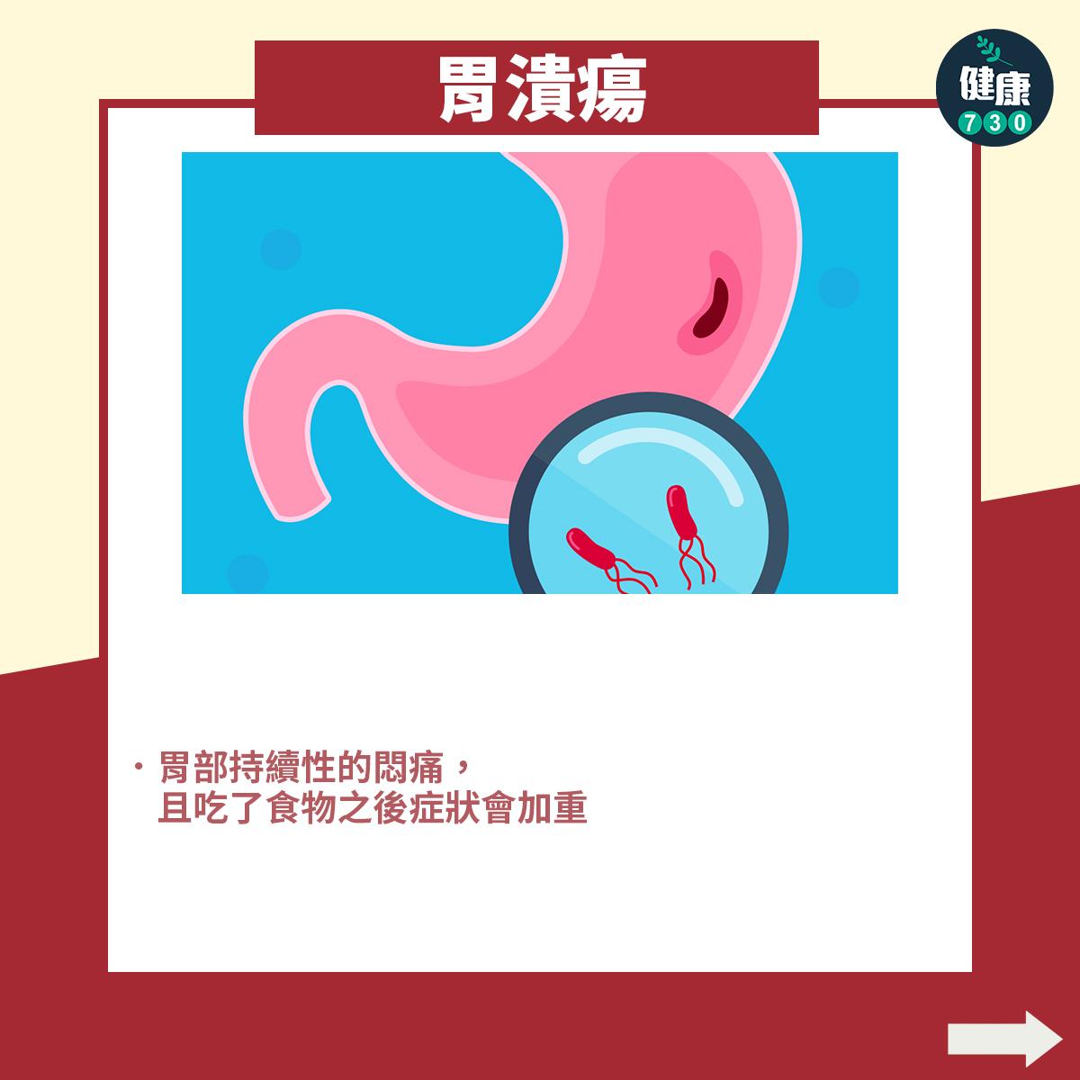 胃痛|胃炎、胃潰瘍、胃酸倒流症候分別?專科醫生教你(am730製圖)