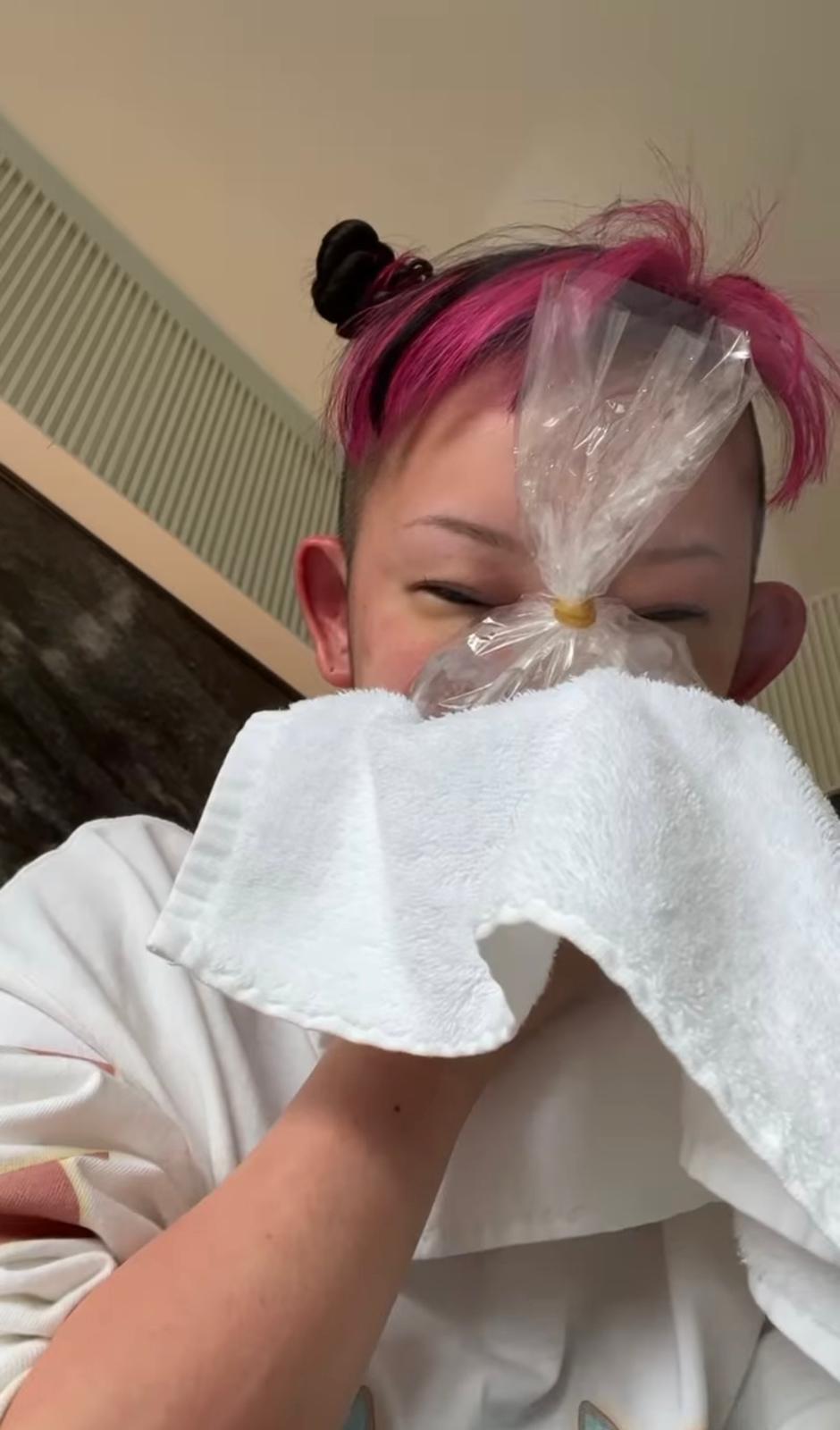 詩羽離港前忽然出風赧,當她返日後自拍腫樣報平安。