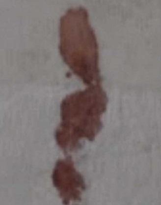 詭異的血跡。(互聯網)