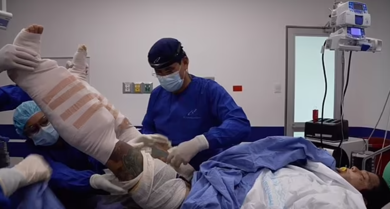 科西奧接受了增高手術。(互聯網)