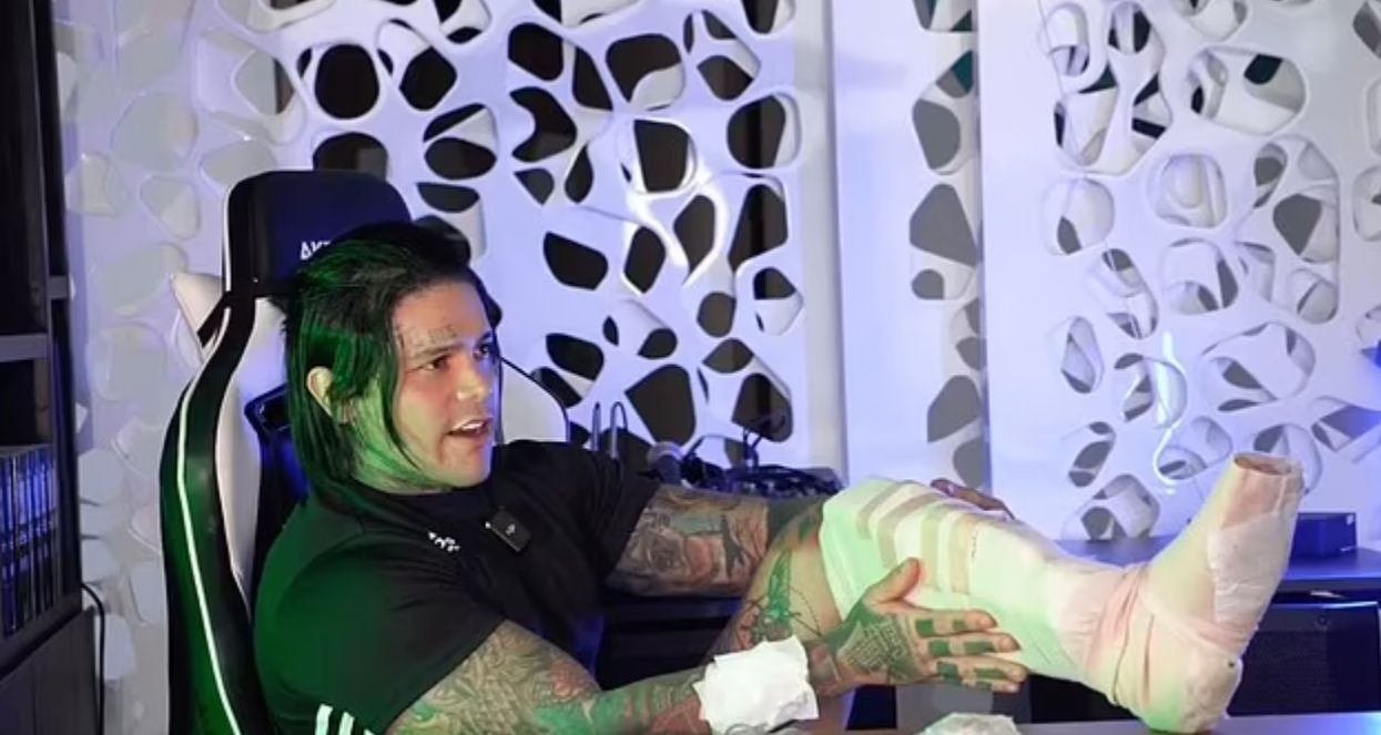 科西奧接受了增高手術。(互聯網)