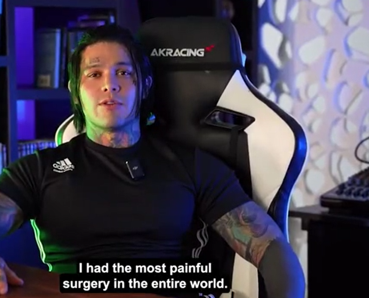 科西奧接受了增高手術。(互聯網)