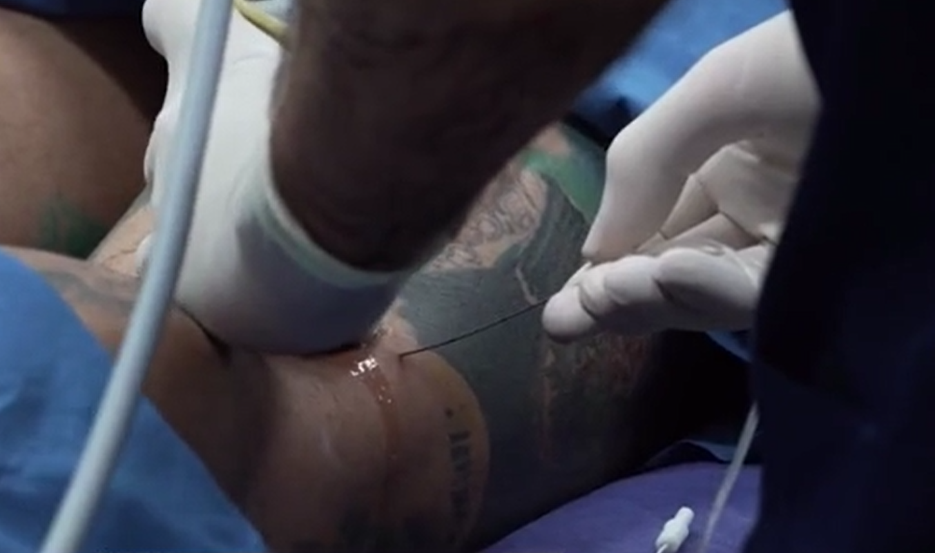 科西奧接受了增高手術。(互聯網)