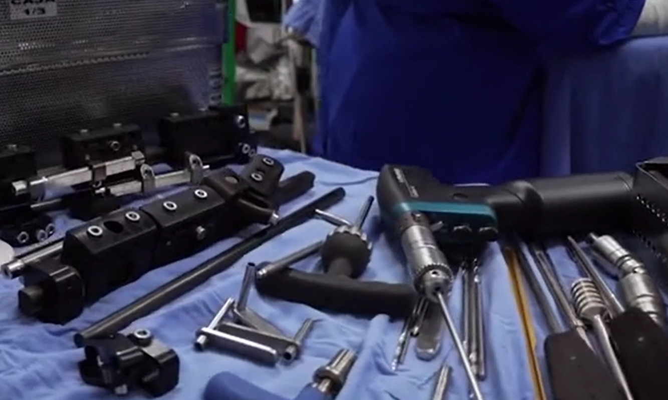 科西奧接受了增高手術。(互聯網)