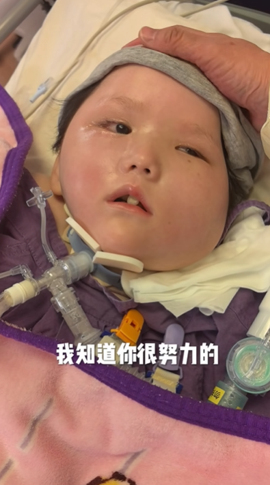 天瑜爸爸昨日(29日)晚上在社交平台上傳影片,指天瑜上周胃出血,已差不多一周沒有喝奶,只靠吊鹽水和葡萄糖水維持,又指天瑜目前已完全沒有使用強心藥,「都是靠自己」。(天瑜醫療事故關注組FB)