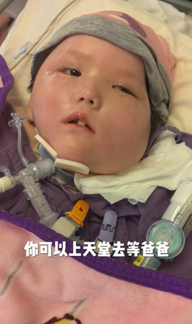 天瑜爸爸昨日(29日)晚上在社交平台上傳影片,指天瑜上周胃出血,已差不多一周沒有喝奶,只靠吊鹽水和葡萄糖水維持,又指天瑜目前已完全沒有使用強心藥,「都是靠自己」。(天瑜醫療事故關注組FB)