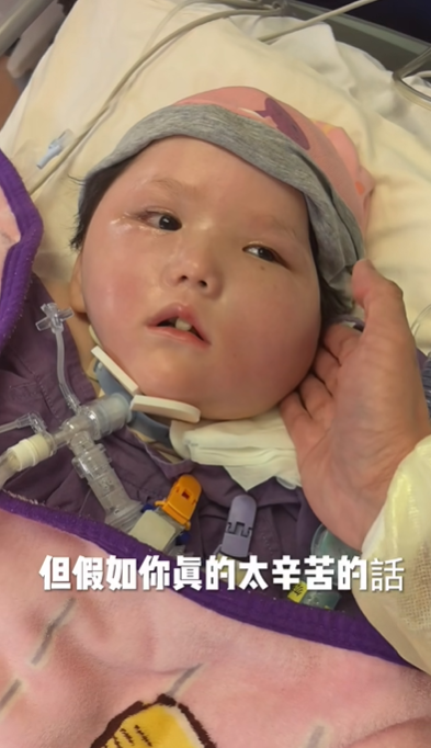 天瑜爸爸昨日(29日)晚上在社交平台上傳影片,指天瑜上周胃出血,已差不多一周沒有喝奶,只靠吊鹽水和葡萄糖水維持,又指天瑜目前已完全沒有使用強心藥,「都是靠自己」。(天瑜醫療事故關注組FB)