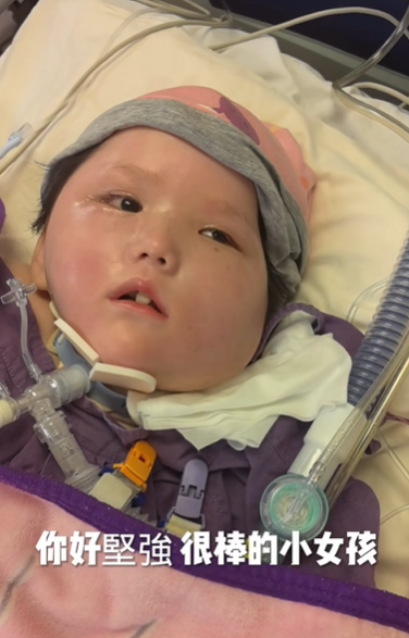 天瑜爸爸昨日(29日)晚上在社交平台上傳影片,指天瑜上周胃出血,已差不多一周沒有喝奶,只靠吊鹽水和葡萄糖水維持,又指天瑜目前已完全沒有使用強心藥,「都是靠自己」。(天瑜醫療事故關注組FB)