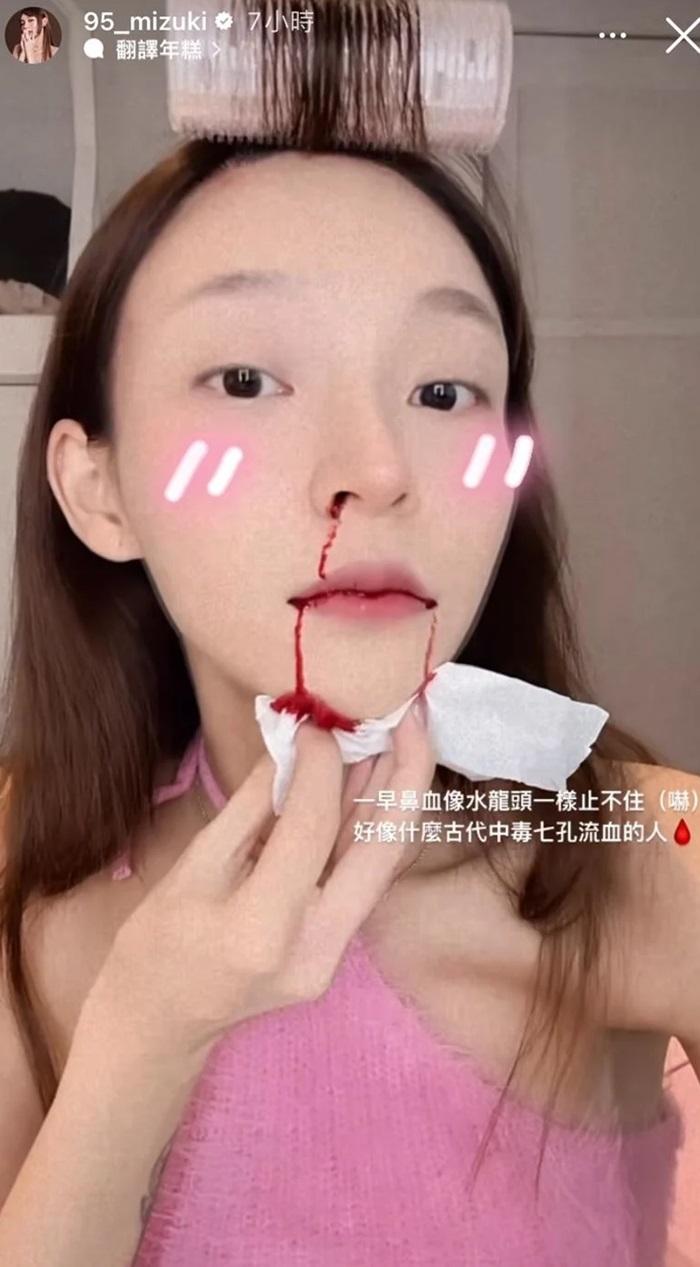 林襄po流血相,留言:像七孔流血。