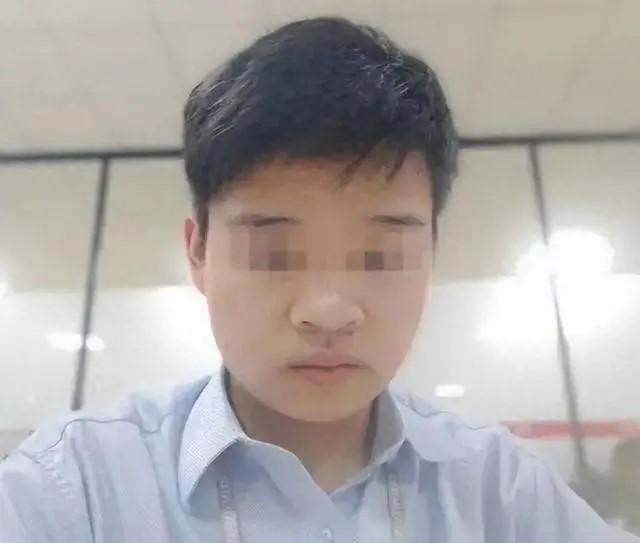 湖南一名23歲男子畢業後,到深圳擔任汽車工程師,惟去年到當地醫院拔智慧齒後,在拍X光片的診室內突然暈倒,轉到急診科診治期間出現噴射狀嘔吐及抽搐。他要接受開顱手術,兩周後不治身亡。當地衛健部門已介入調查事件。