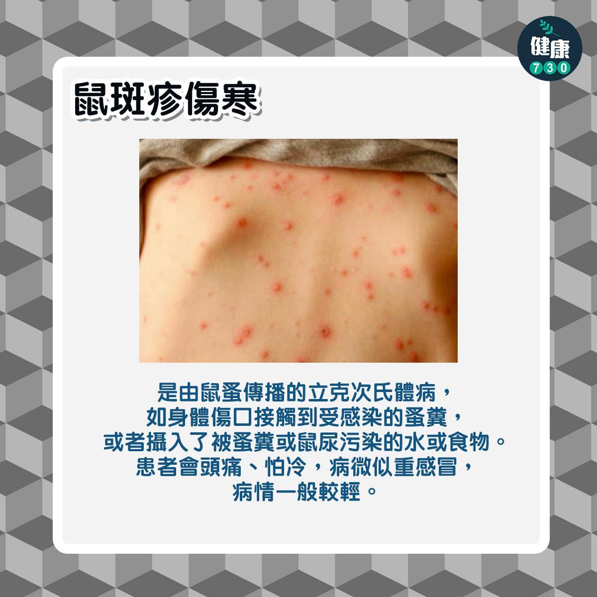 鼠患|6大常見老鼠傳染病,包括鼠疫及鼠斑疹傷寒(am730製圖)