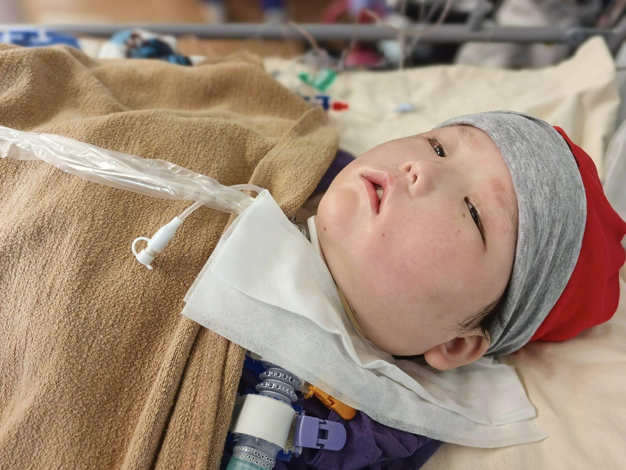 天瑜爸爸上月發文,天瑜心臟開始衰竭,就算用強心藥都起不了很大作用,生命可能已經正在倒數,家人已做最壞打算。(天瑜醫療事故關注組FB)