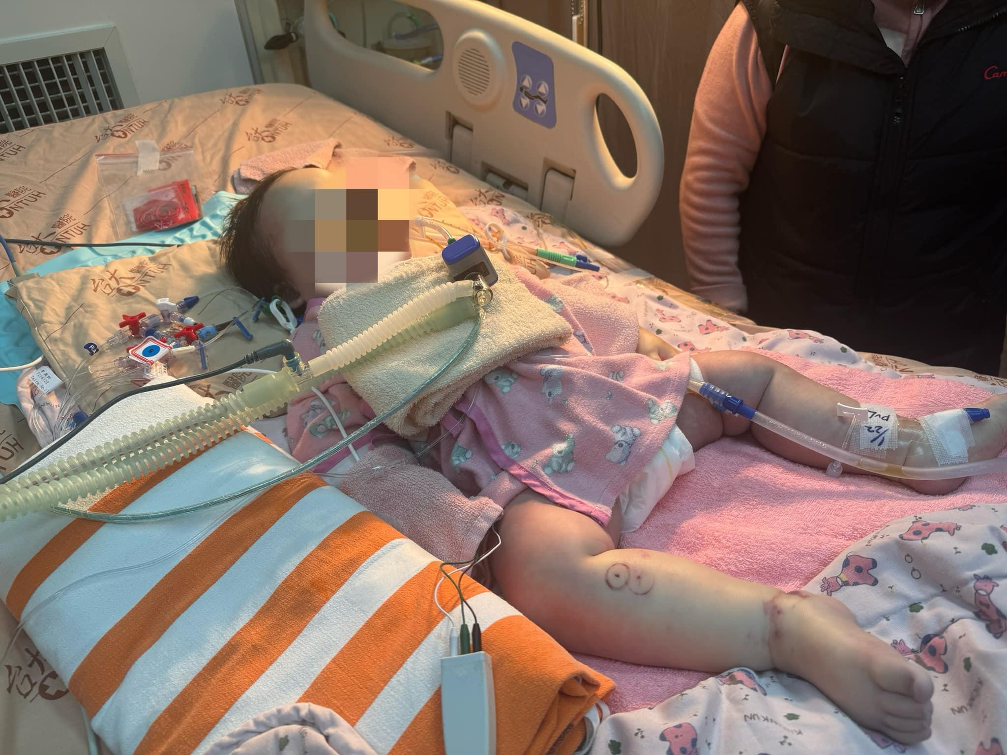 台灣華視主播林彥汝昨日(24日)在社交平台轉發友人文章,表示對方姊姊的孩子疑因托兒中心的疏忽,戴口罩時窒息逝世,經查發現有可能是鼻水及眼淚沾濕口罩引致。