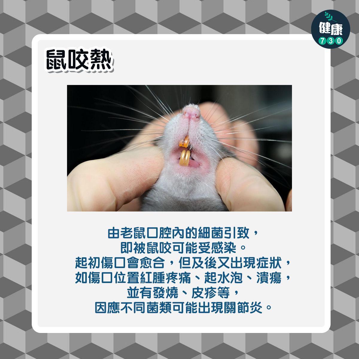 鼠患|6大常見老鼠傳染病,包括鼠疫及鼠斑疹傷寒(am730製圖)