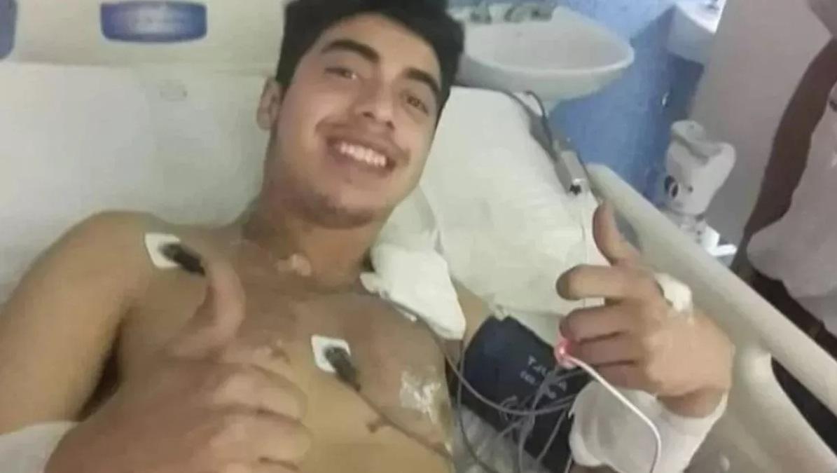 貝隆被雷電擊中,執番條命。(互聯網)