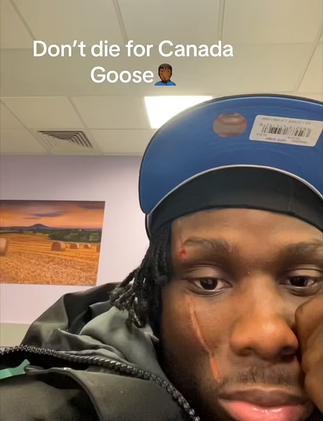 早前一名男子臉部受傷求醫,指遭搶劫,叫民眾穿Canada Goose外出要小心。(互聯網)