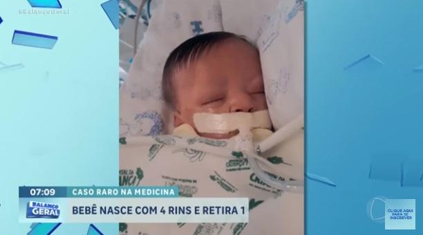 出生不久的阿爾維斯。(互聯網)