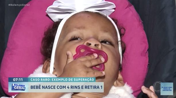 阿爾維斯健康成長。(互聯網)