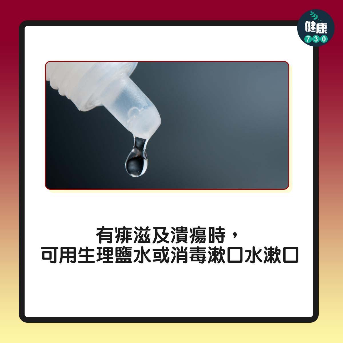 打邊爐易生痱滋及灼傷點算好?5大食火鍋注意事項(am730製圖)