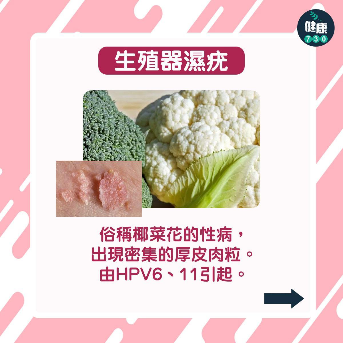 HPV病毒或會引致疣及癌症等。(am730製圖)