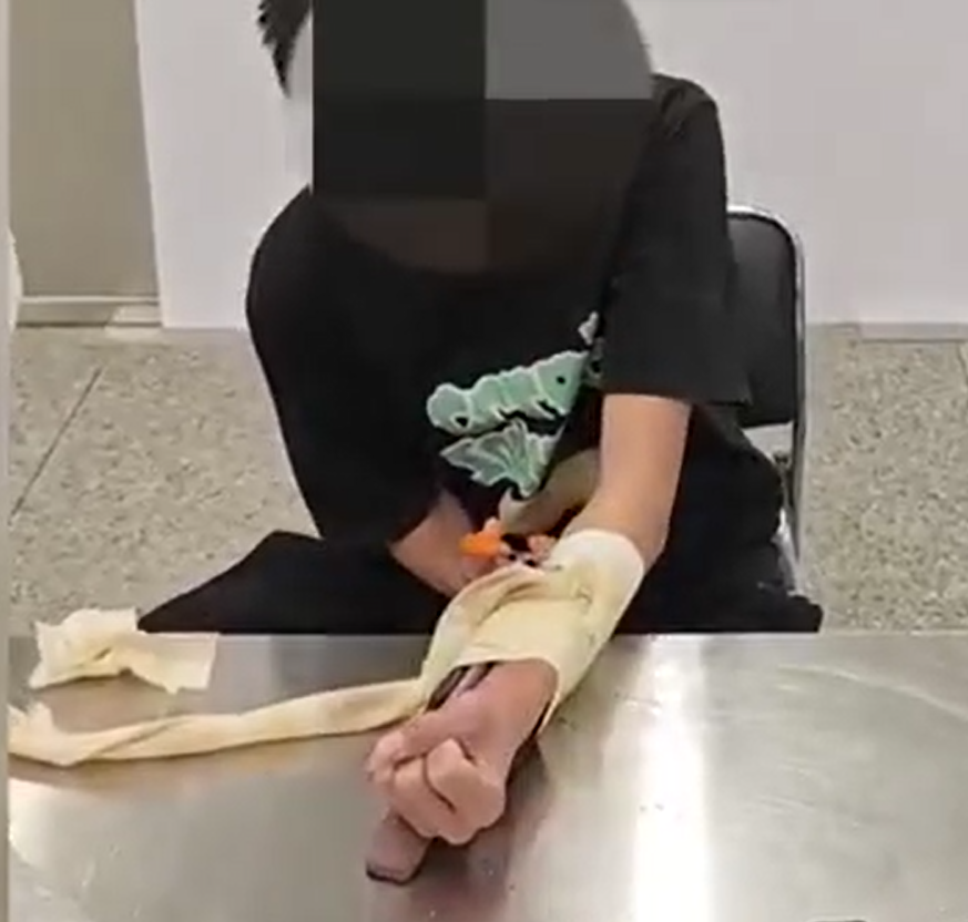 廣東省深圳市福田口岸近日有一名入境旅客假扮手臂受傷,將共重3公斤的金條藏在護具內圖蒙混過關,最終遭皇崗海關截獲。(中國海關)