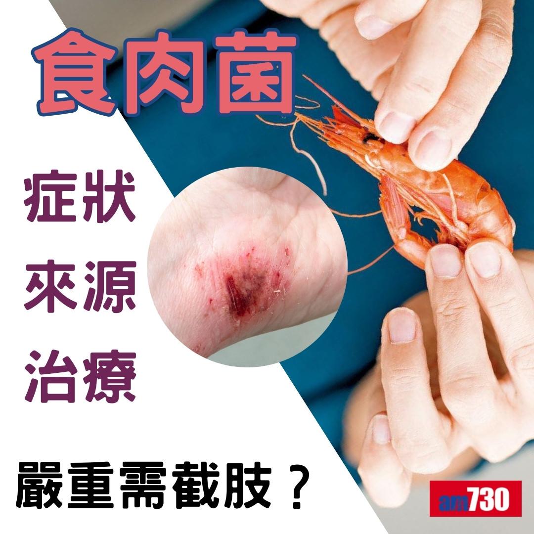 食肉菌症狀、來源及治療方法,嚴重感染需截肢?(am730製圖)