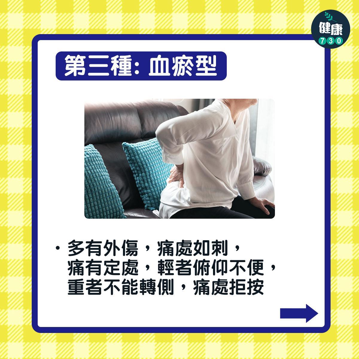 腰痛分類,同小便有關?(am730製圖)