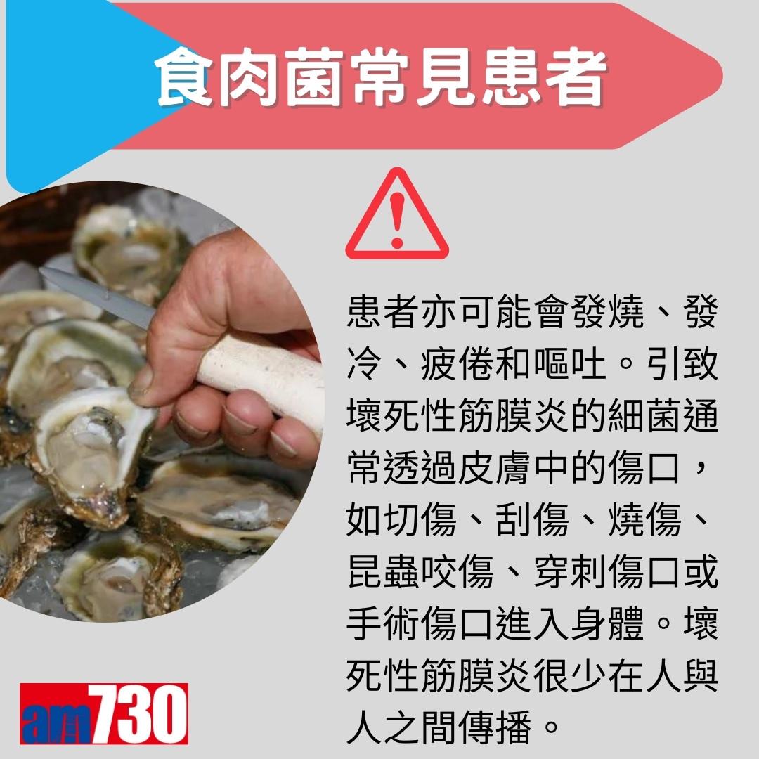 食肉菌症狀、來源及治療方法,嚴重感染需截肢?(am730製圖)